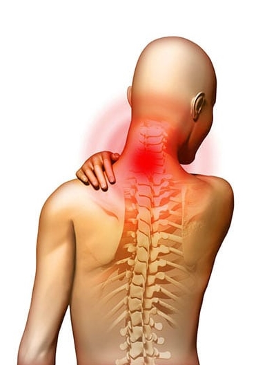 Невралгия шеи: причины, симптомы и лечение